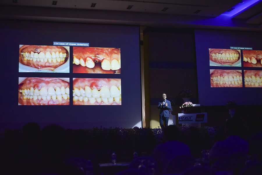งานประชุมวิชาการรากฟันเทียม นานาชาติ The 4th Thai - German International Congress