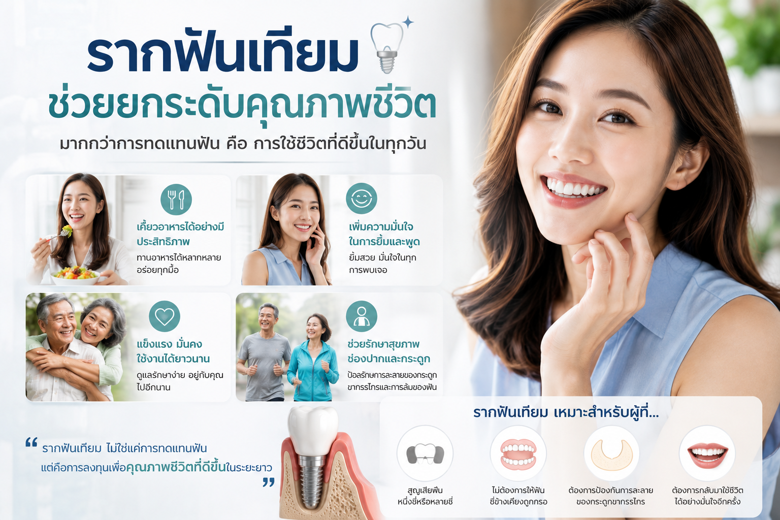 10 ข้อดีของการใส่รากฟันเทียม