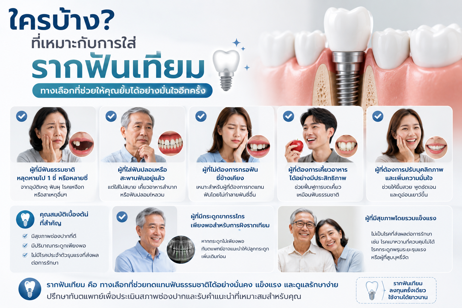 ข้อดีของการใส่รากฟันเทียม