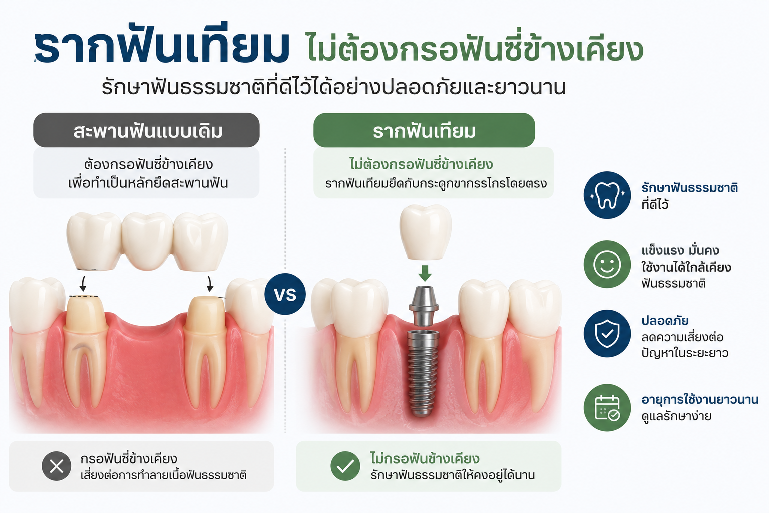 10 ข้อดีของการใส่รากฟันเทียม