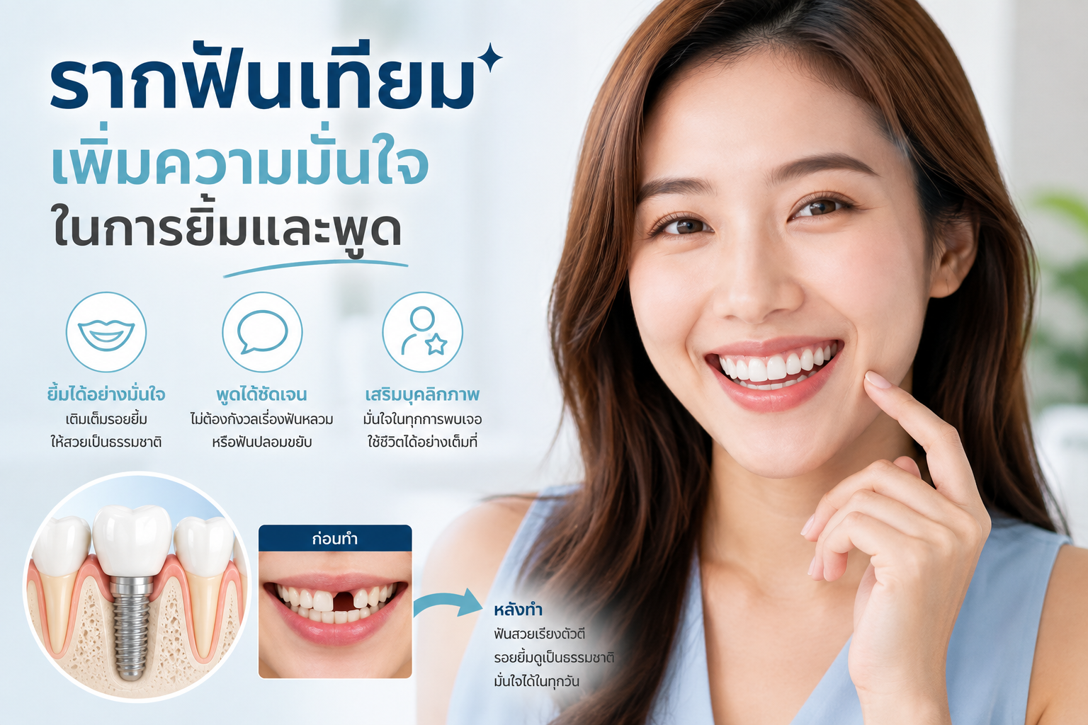 10 ข้อดีของการใส่รากฟันเทียม