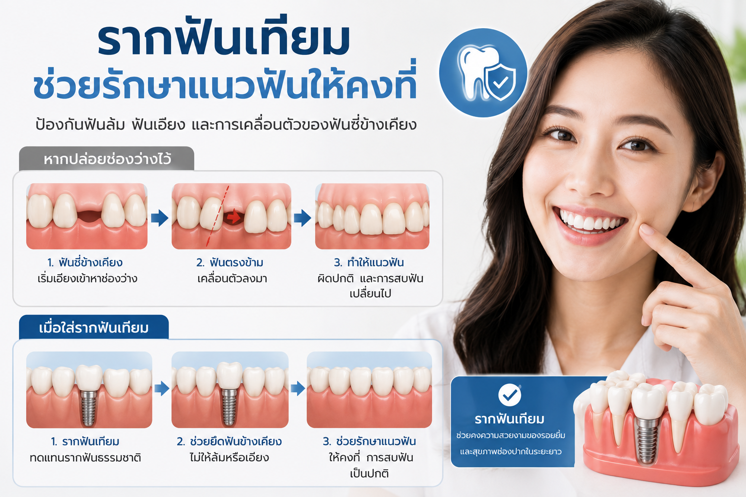 10 ข้อดีของการใส่รากฟันเทียม