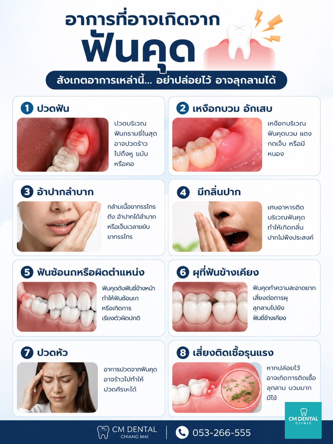 ผ่าฟันคุดเชียงใหม่