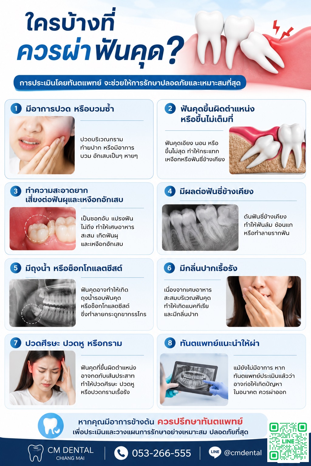 ผ่าฟันคุดเชียงใหม่