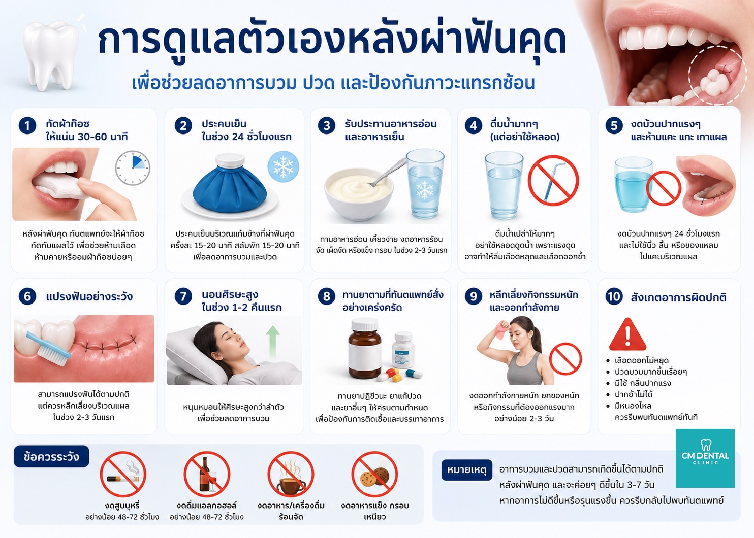 ผ่าฟันคุดเชียงใหม่