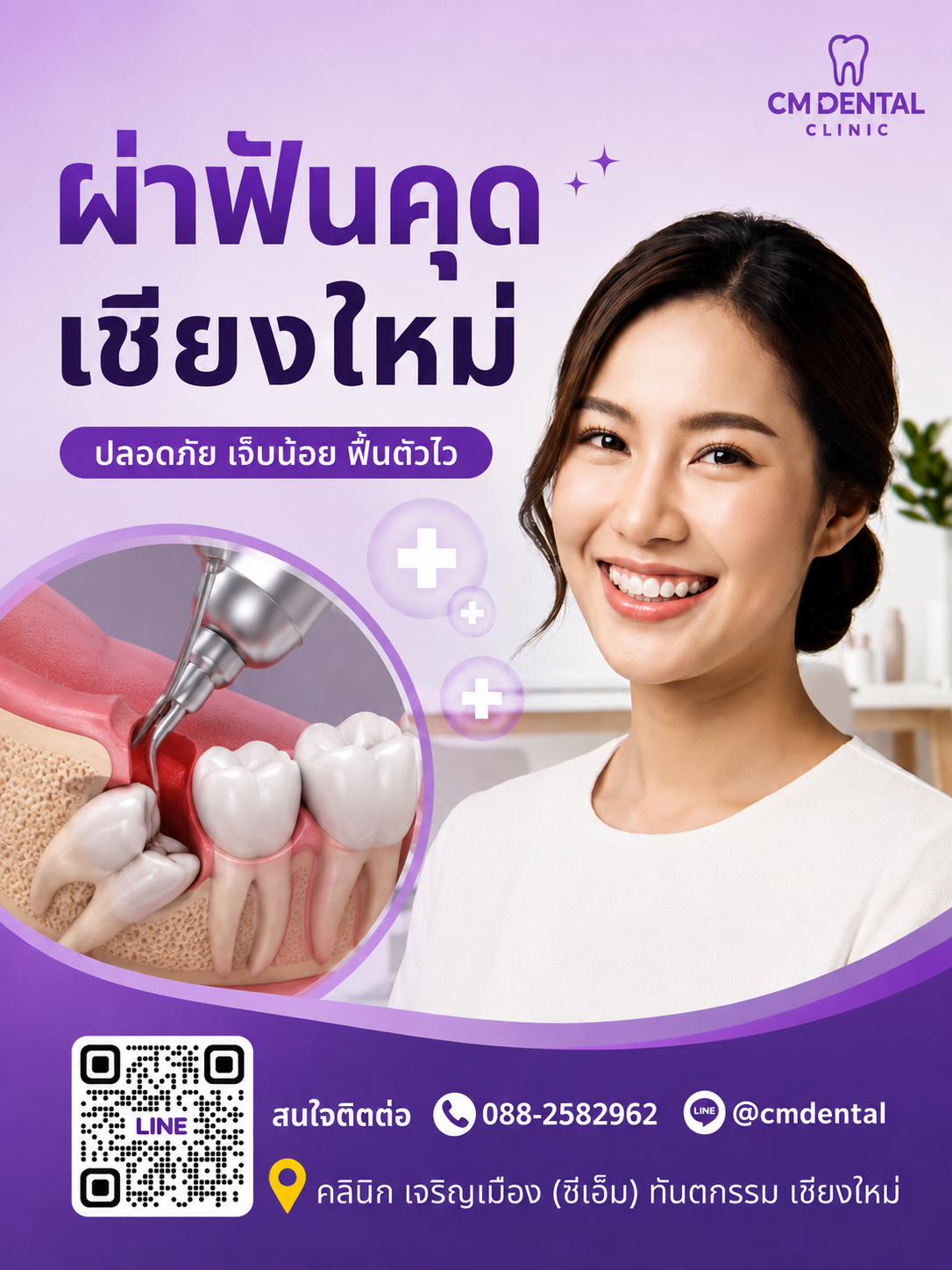 ผ่าฟันคุดเชียงใหม่